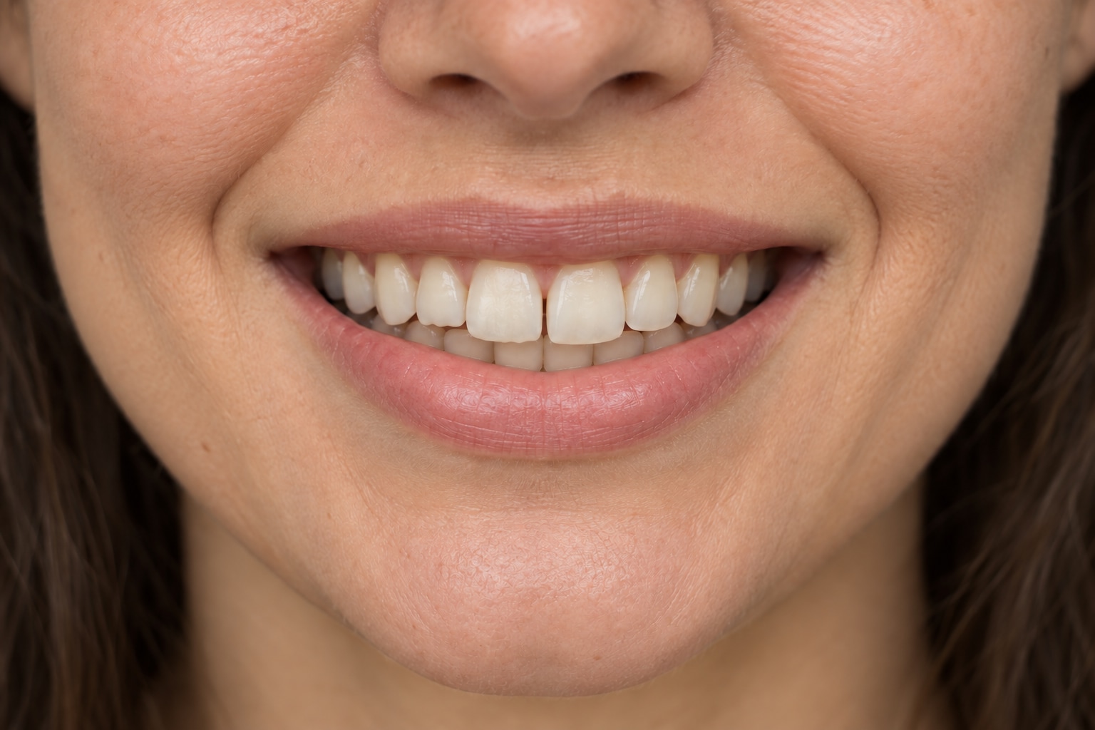 A simulated smile, before the cosmetic changes.